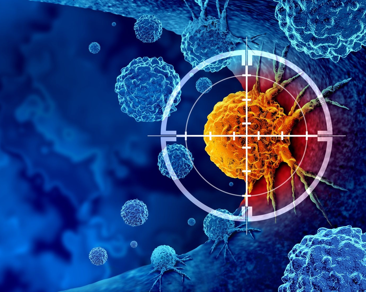 Les microbulles guidées par ultrasons pourraient stimuler la réponse immunitaire contre les tumeurs, selon une nouvelle recherche menée à l’Université Concordia